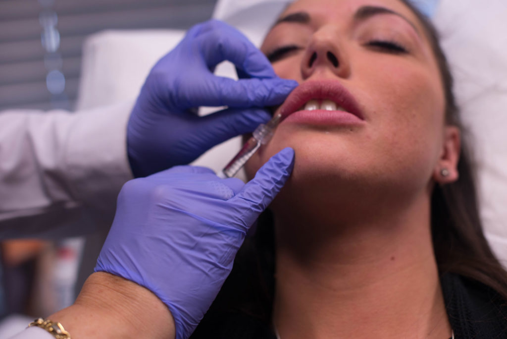 Woman getting dermal filler injection in lips