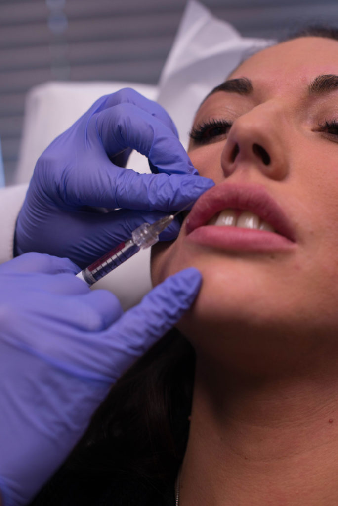 Woman getting dermal filler injection in lips