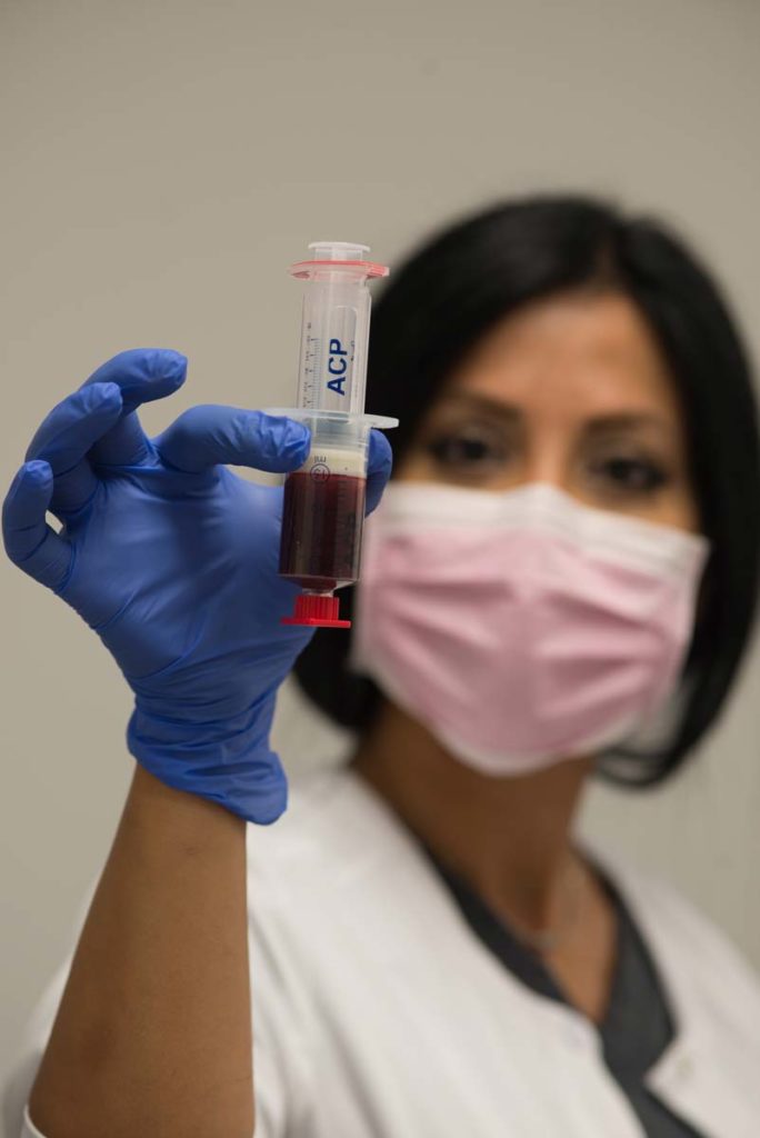 Female technician preparing blood for prp platelet rich plasma vampire facelift