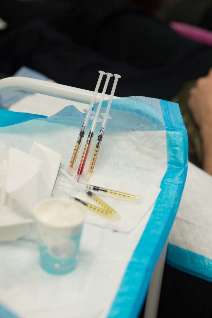 Needles prepared for prp platelet rich plasma vampire facelift