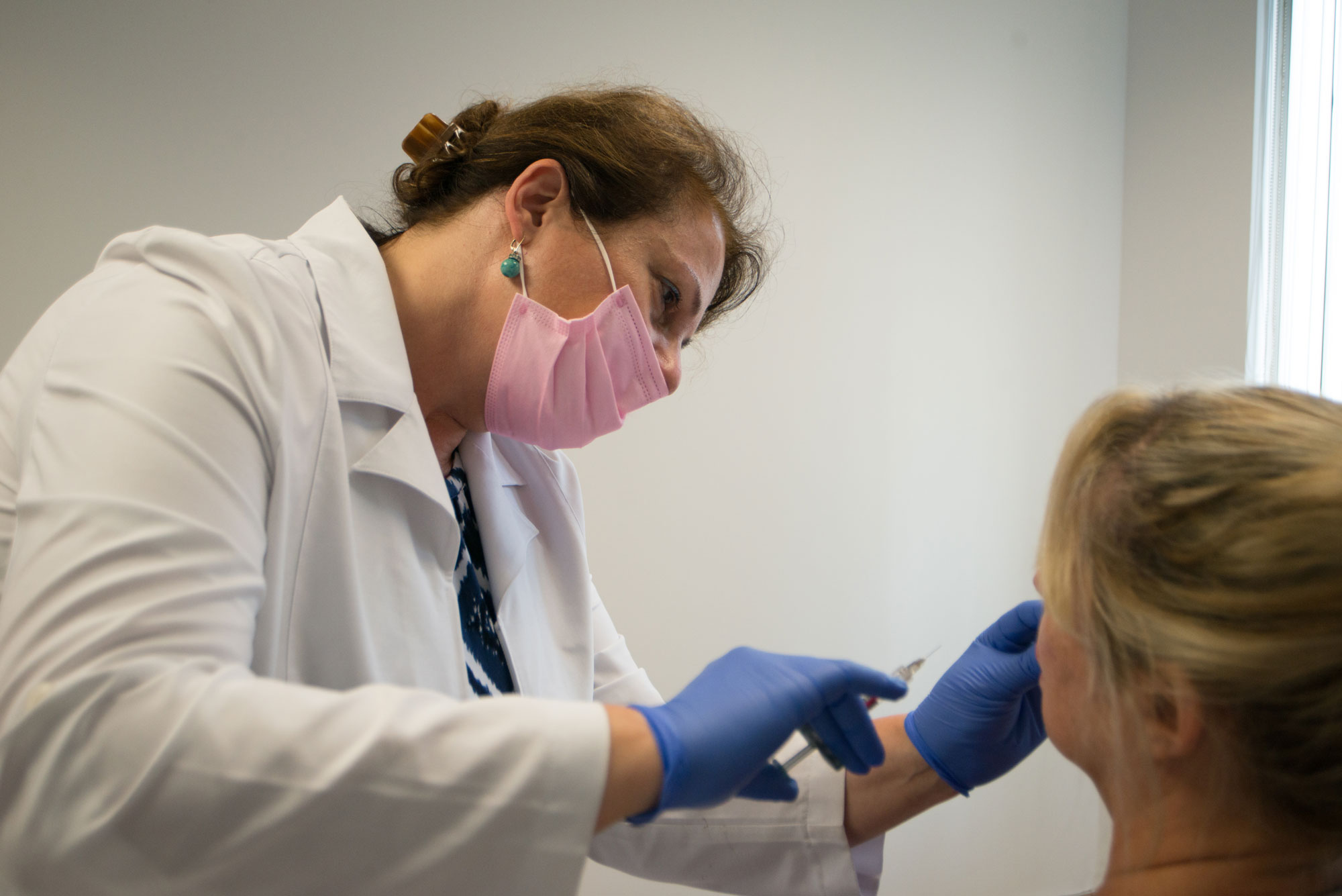 Dermal-filer-Dr-Berbari