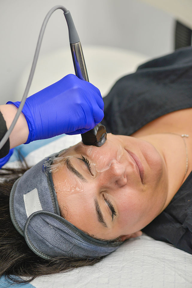 forma Upper face skin lift with radio frequency