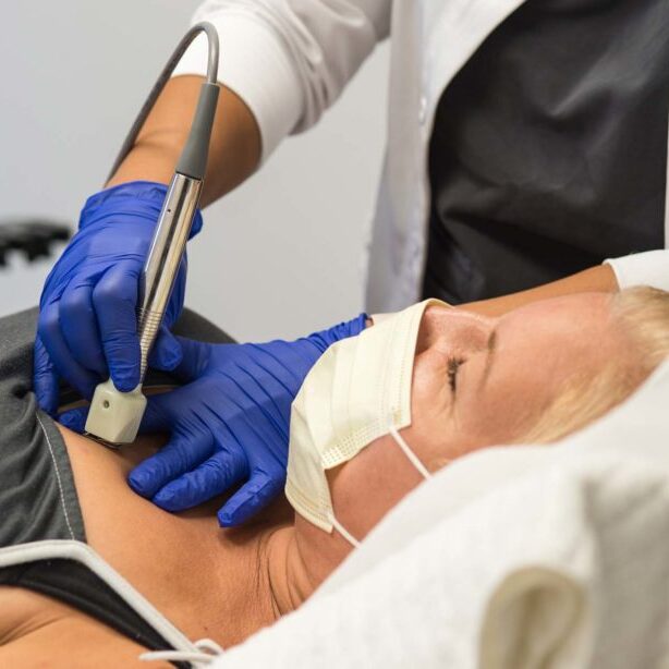 Female patient receiving fractora microneedling treatment